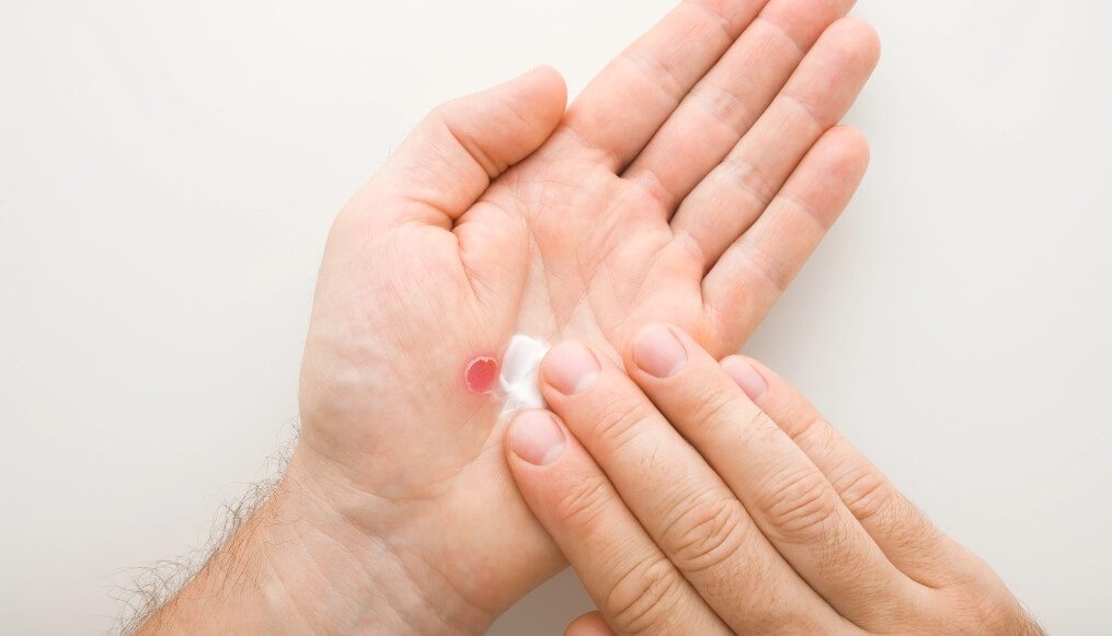 trosyd repair content